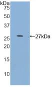 Polyclonal Antibody to Myocilin (MYOC)