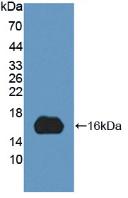 Polyclonal Antibody to C-Myc Binding Protein (MYCBP)