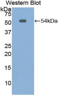 Polyclonal Antibody to Mesothelin (MSLN)