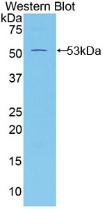 Polyclonal Antibody to Mesothelin (MSLN)