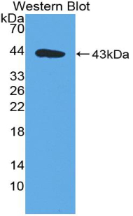 Polyclonal Antibody to Melanoma Inhibitory Activity Protein 1 (MIA1)