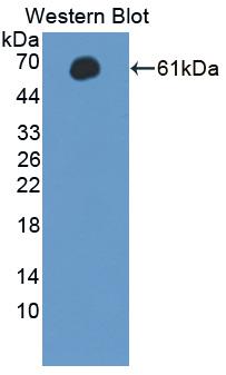 Polyclonal Antibody to Microtubule Associated Serine/Threonine Kinase 2 (MAST2)