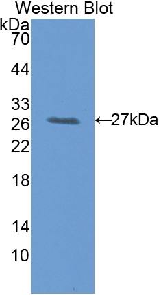 Polyclonal Antibody to Latexin (LXN)