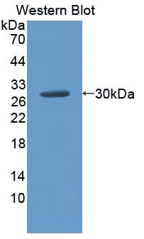 Polyclonal Antibody to Leucine Rich Repeat Kinase 2 (LRRK2)