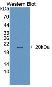 Polyclonal Antibody to Leucine Rich Repeat In FLII Interacting Protein 1 (LRRFIP1)