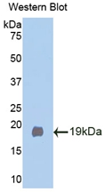 Polyclonal Antibody to Klotho Beta (KLb)