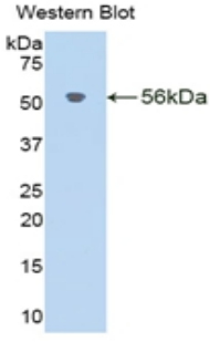 Polyclonal Antibody to Klotho Beta (KLb)