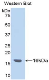 Polyclonal Antibody to Inter Alpha-Globulin Inhibitor H4 (ITIH4)