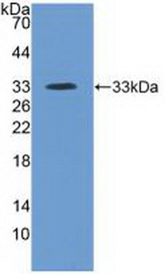 Polyclonal Antibody to Inter Alpha-Globulin Inhibitor H4 (ITIH4)