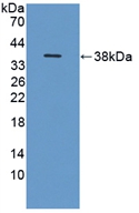 Polyclonal Antibody to Inter Alpha-Globulin Inhibitor H1 (ITIH1)