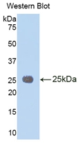 Polyclonal Antibody to Interleukin 1 Receptor Accessory Protein (IL1RAP)