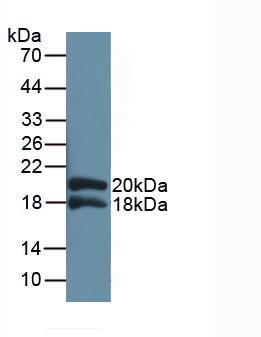 Polyclonal Antibody to Interleukin 1 Receptor Accessory Protein (IL1RAP)