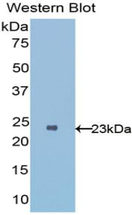 Polyclonal Antibody to Interleukin 1 Receptor Like Protein 1 (IL1RL1)