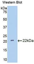 Polyclonal Antibody to Interleukin 18 Binding Protein (IL18BP)