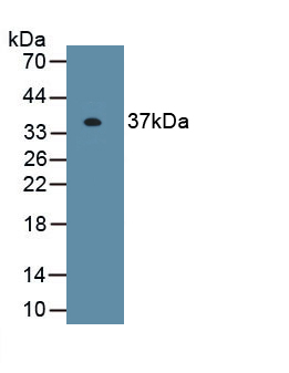 Polyclonal Antibody to Exosome Component 2 (EXOSC2)