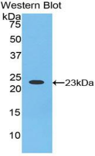 Polyclonal Antibody to Hornerin (HRNR)