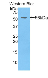 Polyclonal Antibody to Hepatocyte Growth Factor Activator (HGFAC)