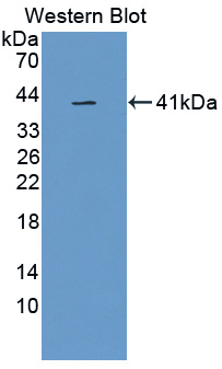 Polyclonal Antibody to Glycosylphosphatidylinositol Specific Phospholipase D1 (GPLD1)