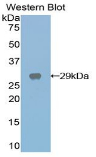 Polyclonal Antibody to Galactose-3-O-Sulfotransferase 1 (GAL3ST1)