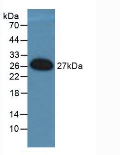 Polyclonal Antibody to FOS Like Antigen 1 (FOSL1)