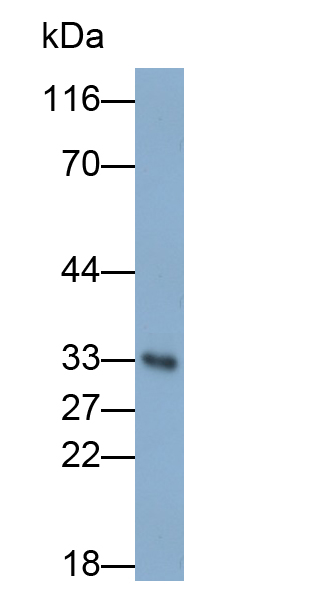 PAJ094Hu01.jpg