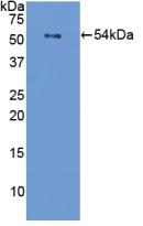 Polyclonal Antibody to Filaggrin (FLG)