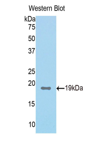 Polyclonal Antibody to Fumarylacetoacetate Hydrolase (FAH)