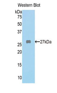 Polyclonal Antibody to Fumarylacetoacetate Hydrolase (FAH)