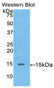 Polyclonal Antibody to Biglycan (BGN)