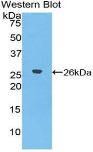 Polyclonal Antibody to Epiphycan (EPYC)