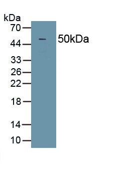 Polyclonal Antibody to Deleted In Malignant Brain Tumors 1 (DMBT1)