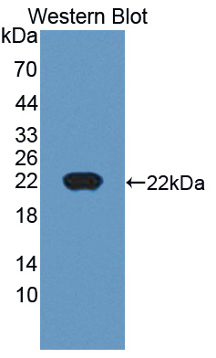 Polyclonal Antibody to Cancer/Testis Antigen 1B (CTAG1B)