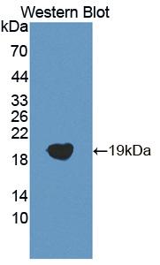 Polyclonal Antibody to Coactosin Like Protein 1 (COTL1)