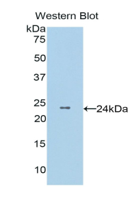 Polyclonal Antibody to Catechol-O-Methyltransferase (COMT)