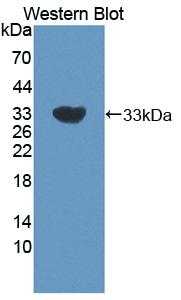 Polyclonal Antibody to Calponin 2 (CNN2)