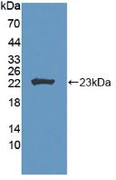 Polyclonal Antibody to Lecithin Cholesterol Acyltransferase (LCAT)