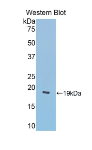 Polyclonal Antibody to Lecithin Cholesterol Acyltransferase (LCAT)