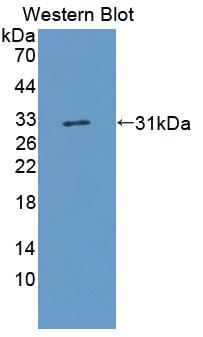 Polyclonal Antibody to BMP Binding Endothelial Regulator (BMPER)