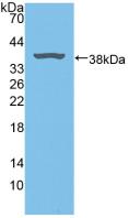 Polyclonal Antibody to Biliverdin Reductase A (BLVRA)