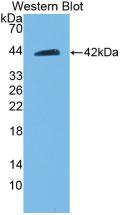 Polyclonal Antibody to Beclin 1 (BECN1)