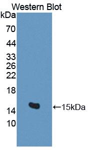 Polyclonal Antibody to BMP And Activin Membrane Bound Inhibitor Homolog (BAMBI)