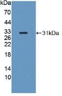 Polyclonal Antibody to Beta-1,4-N-Acetyl Galactosaminyl Transferase 2 (b4GALNT2)