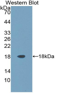 Polyclonal Antibody to Artemin (ARTN)
