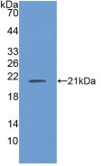 Polyclonal Antibody to Acidic Nuclear Phosphoprotein 32 Family, Member A (ANP32A)