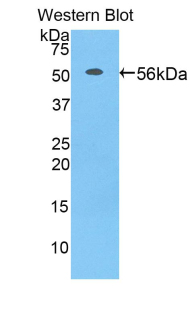 Polyclonal Antibody to Acidic Nuclear Phosphoprotein 32 Family, Member A (ANP32A)