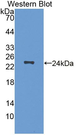 Polyclonal Antibody to Acetylcholinesterase Associated Protein (ACHAP)