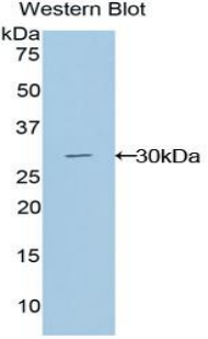 Polyclonal Antibody to GLI Family Zinc Finger Protein 3 (GLI3)