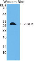 Polyclonal Antibody to Cbp/p300 Interacting Transactivator, With Glu/Asp Rich Carboxy Terminal Domain 1 (CITED1)