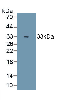 Polyclonal Antibody to Zinc Finger Homeobox Protein 1B (ZFHX1B)