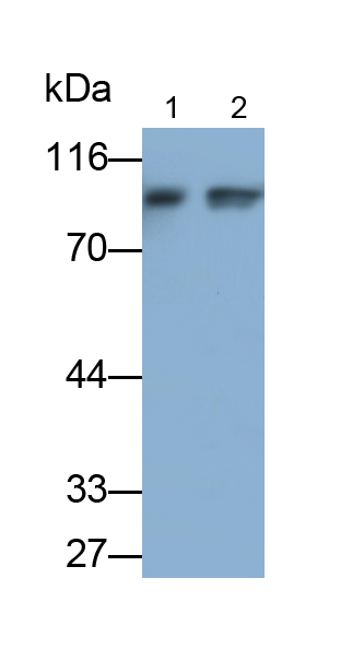 Polyclonal Antibody to Inhibitor Of Kappa-Light Polypeptide Gene Enhancer In B-Cells Kinase Beta (IkBKb)